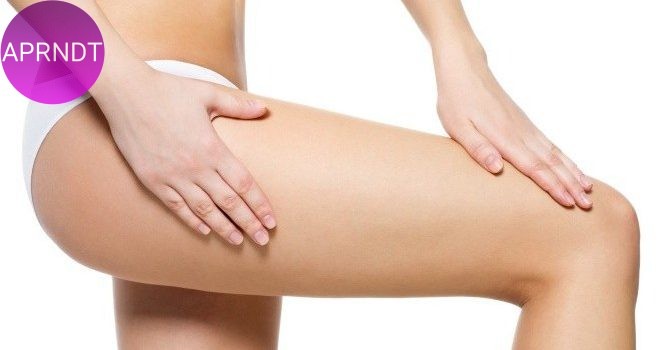 Eliminar las estrías en 7 pasos