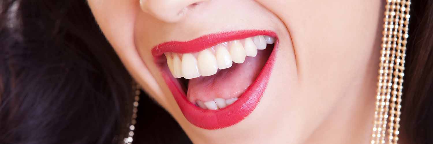 Mujer con amplia sonrisa, labios rojos y dientes blancos y alineados.